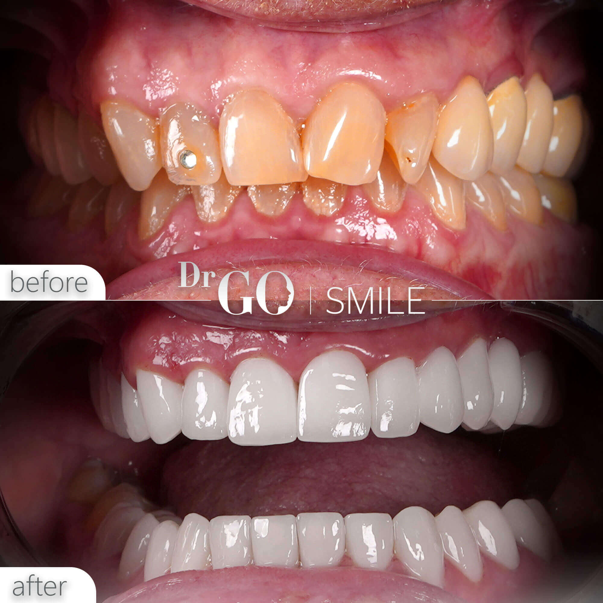 Drgo Smile Before After 2