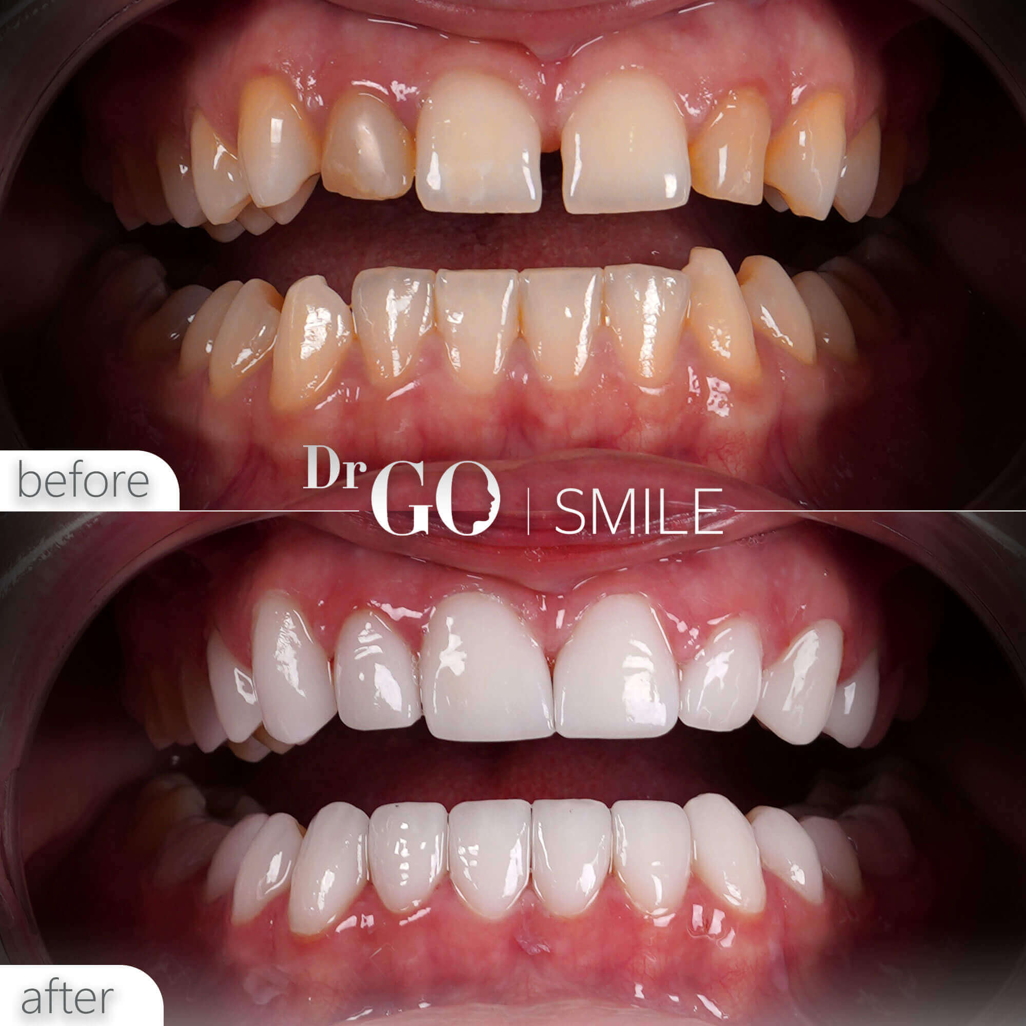 Drgo Smile Before After 3