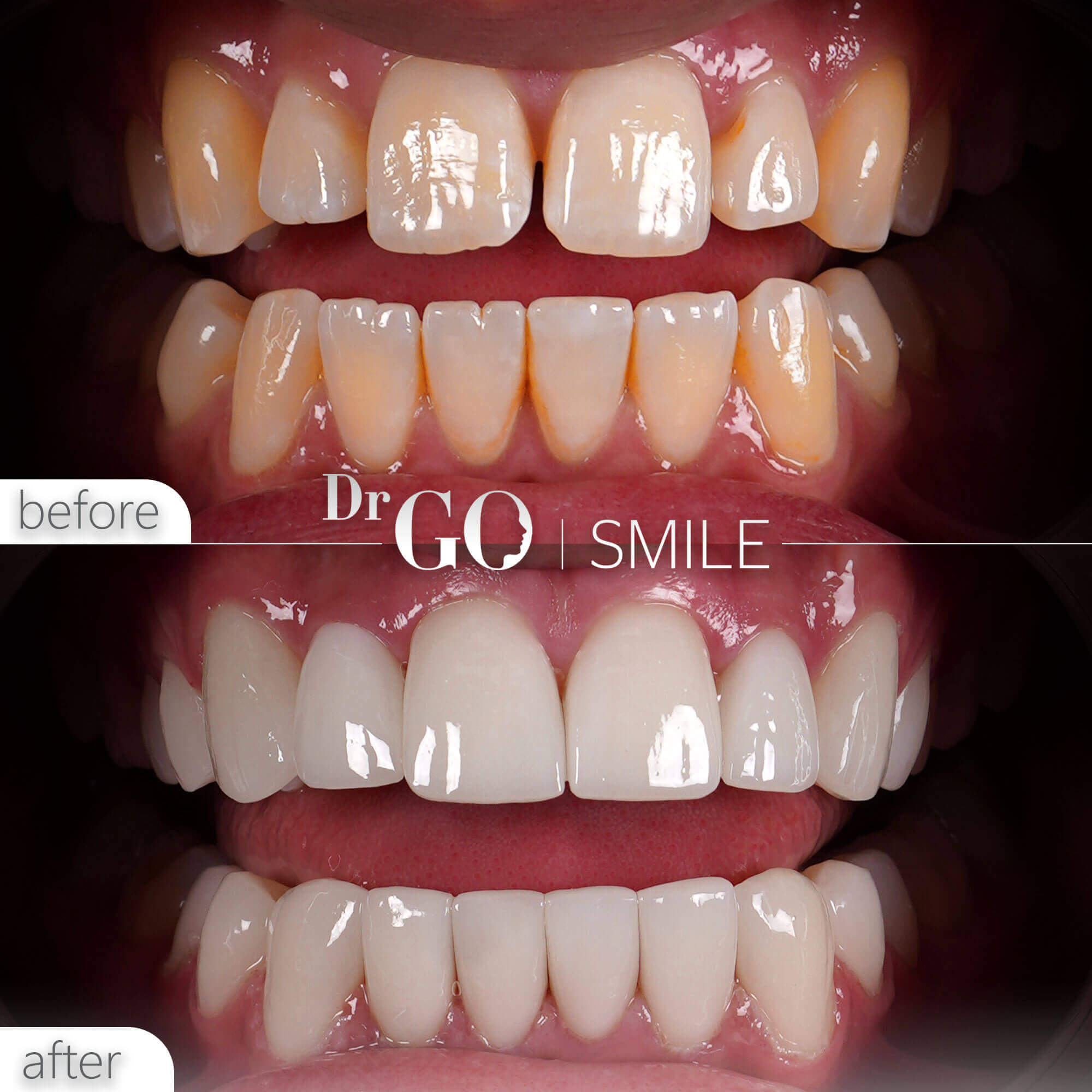 Drgo Smile Before After 7