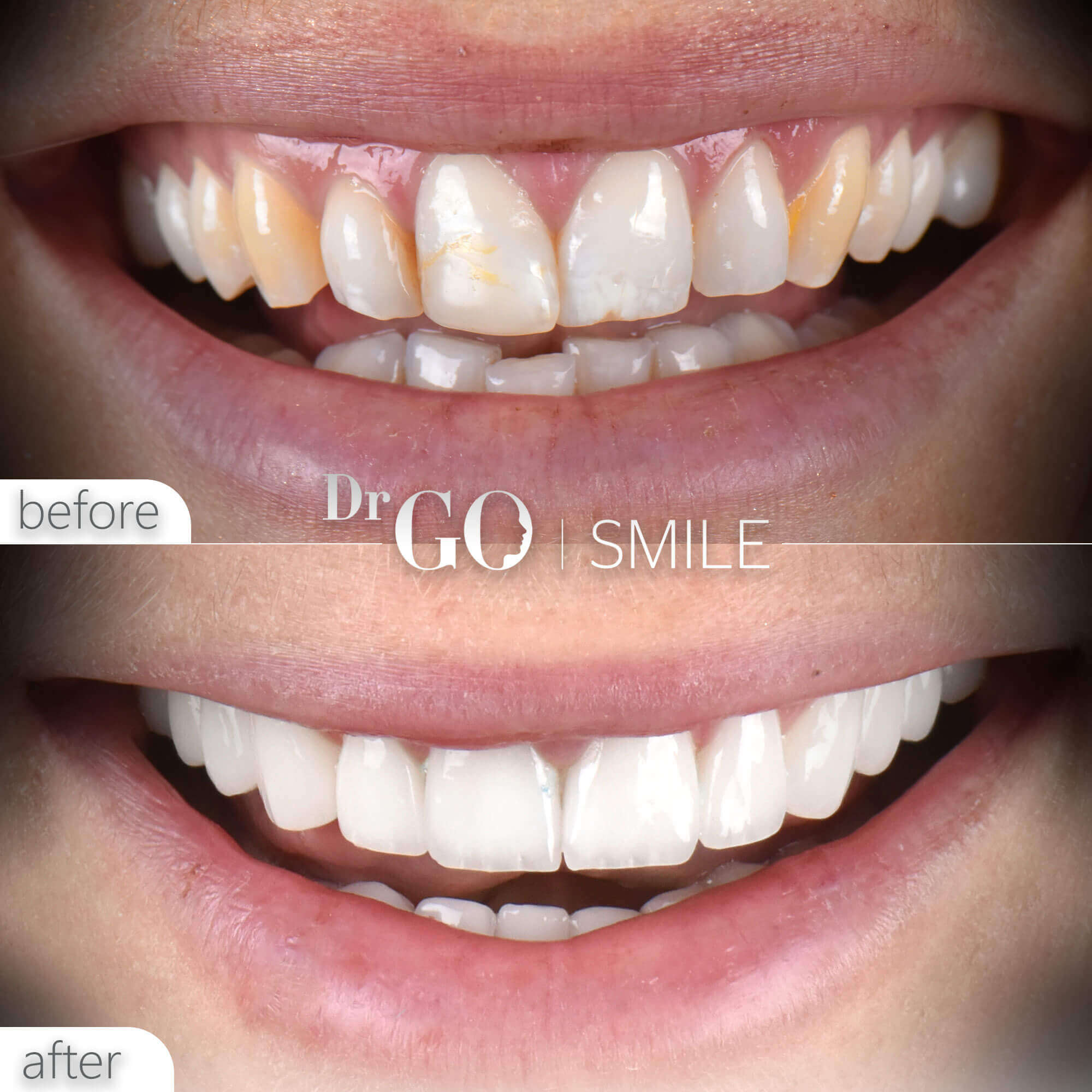 Drgo Smile Before After 8