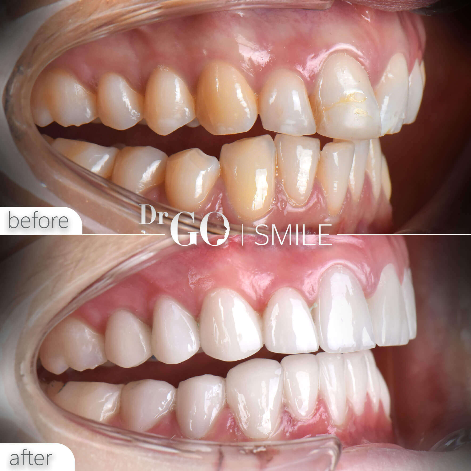 Drgo Smile Before After 9