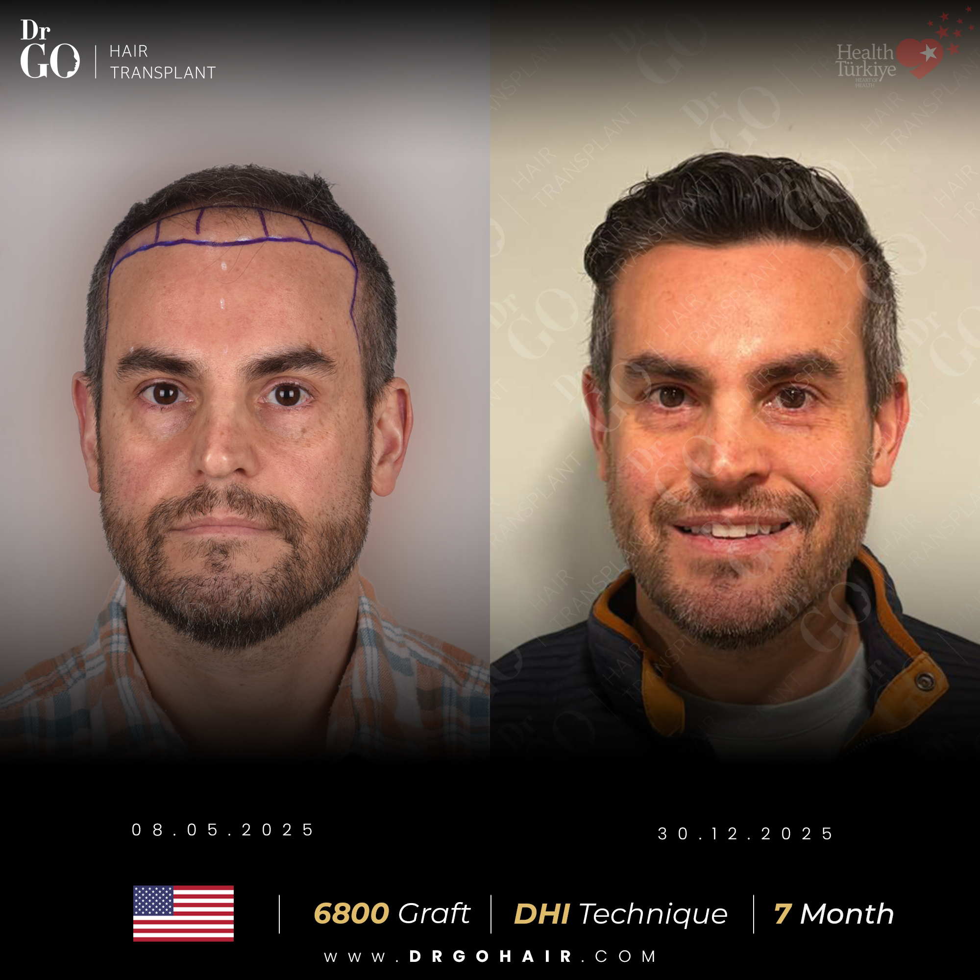 30.12.2025 - drgohair