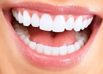 Hollywood Smile