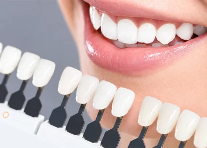 Zirconium Crowns
