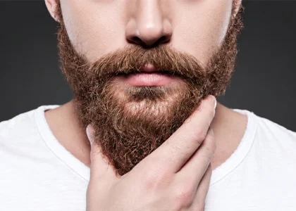 Beard Transplant